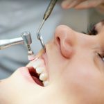 About Dental Teeth Cleanings
