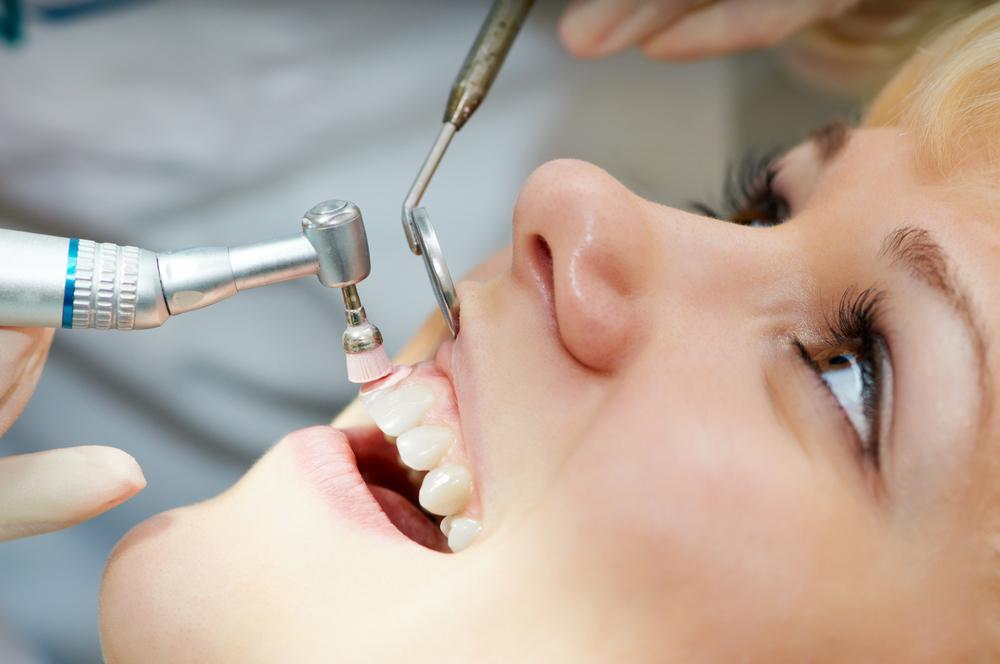What Happens During a Teeth Cleaning | Port Coquitlam | Encore Dental